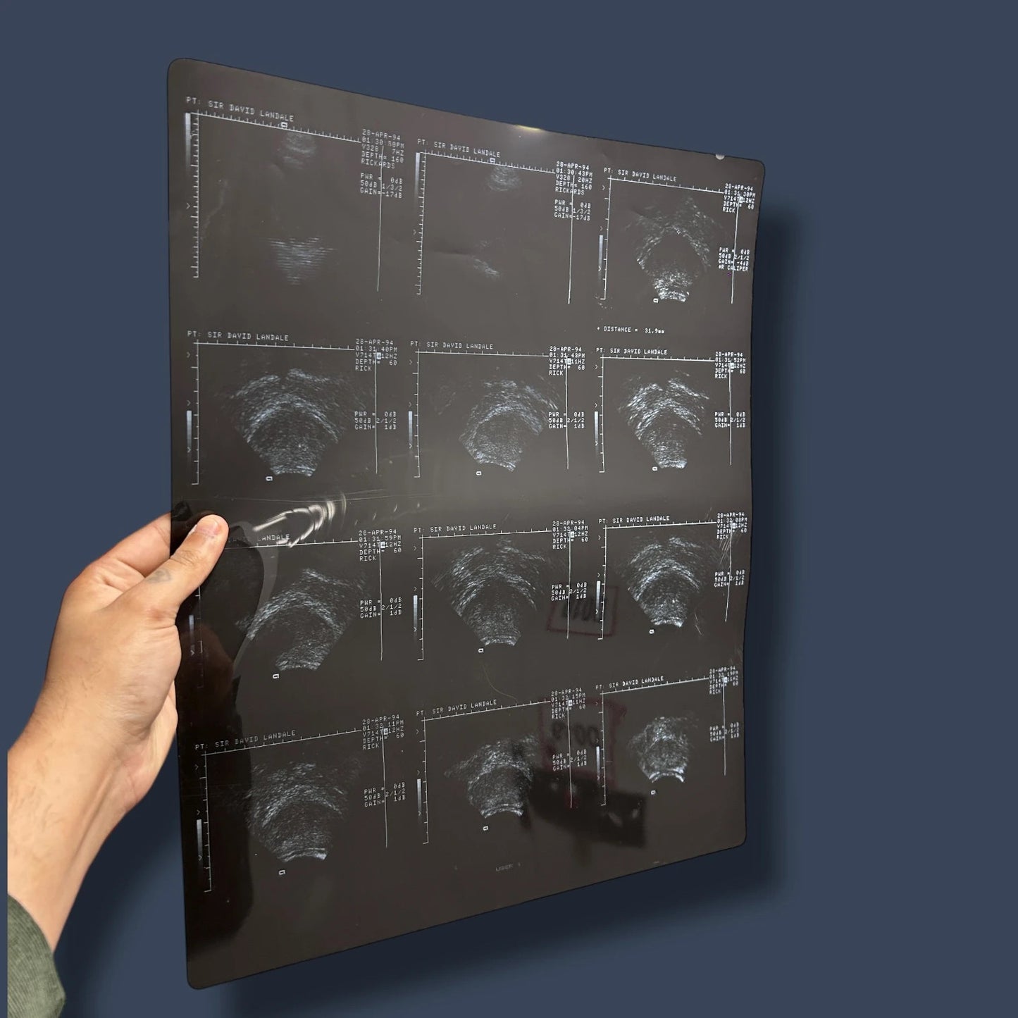 Vintage X Ray Ultrasound Scan Acetate Film Clipping