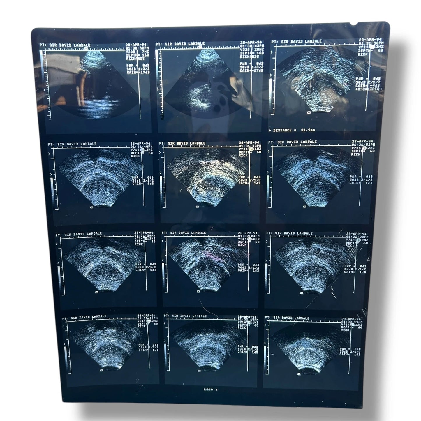 Vintage Medical Ultrasound Film – Retro Sonogram Imaging | Anatomical Wall Art, Science Deco