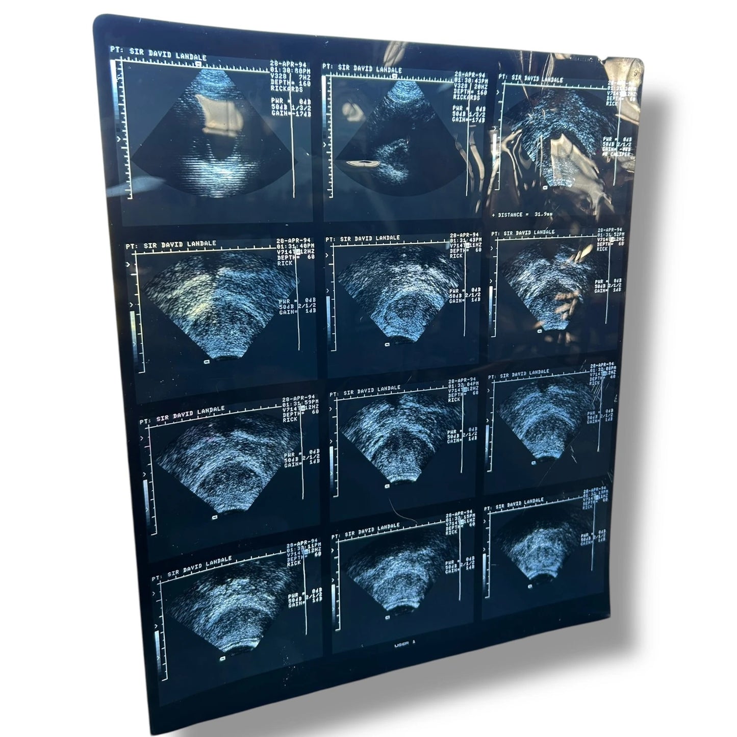 Vintage Medical Ultrasound Film – Retro Sonogram Imaging | Anatomical Wall Art, Science Deco