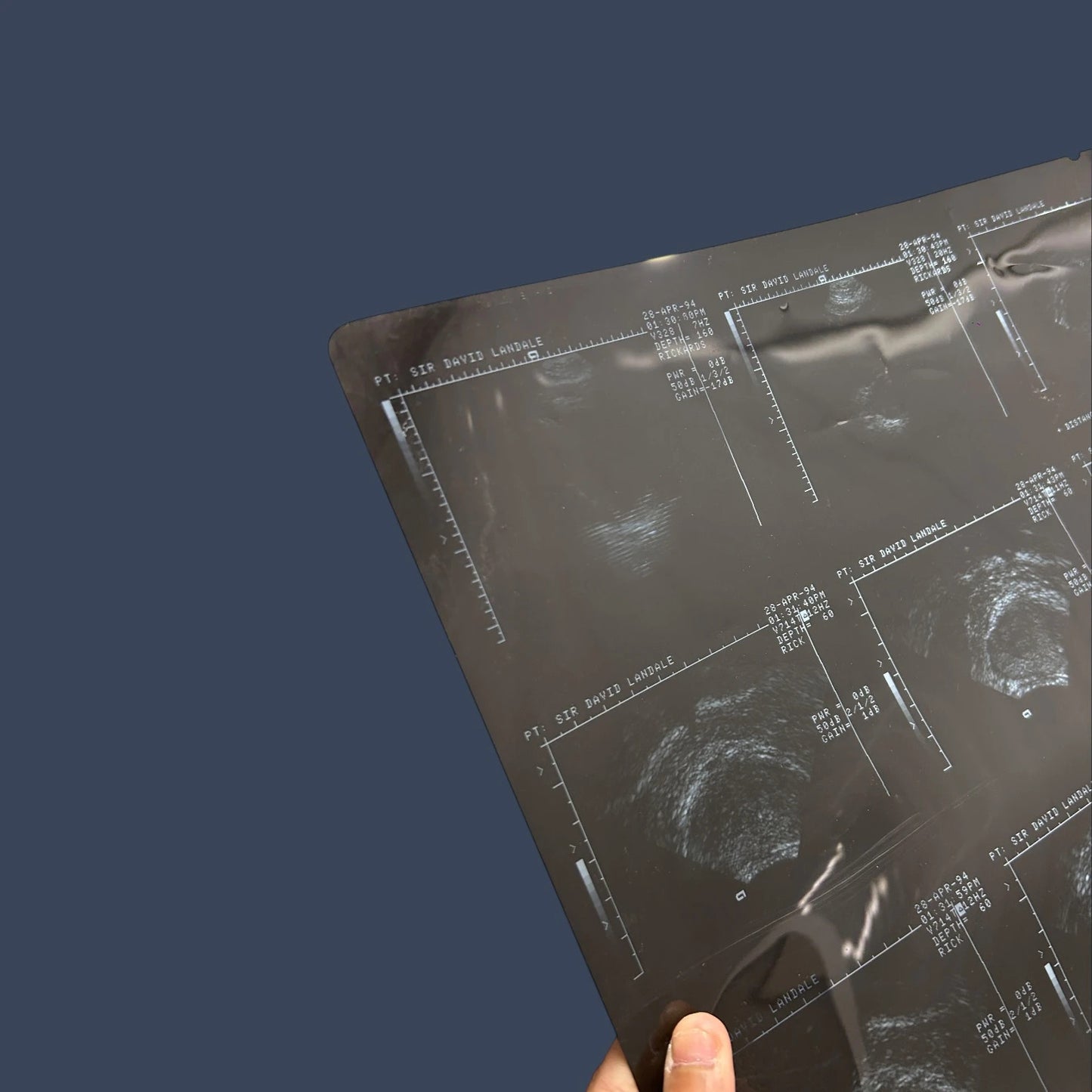 Vintage X Ray Ultrasound Scan Acetate Film Clipping