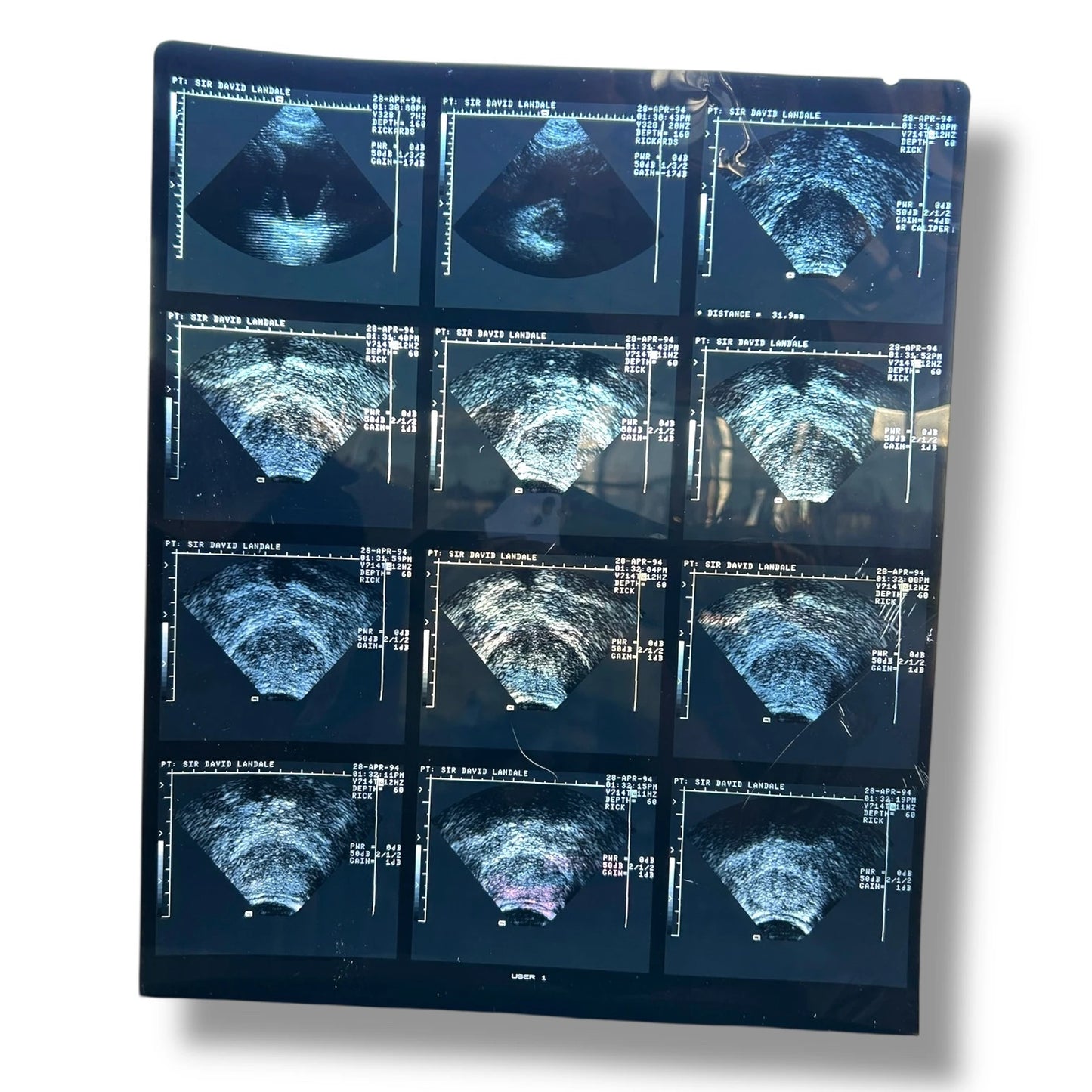 Vintage Medical Ultrasound Film – Retro Sonogram Imaging | Anatomical Wall Art, Science Deco