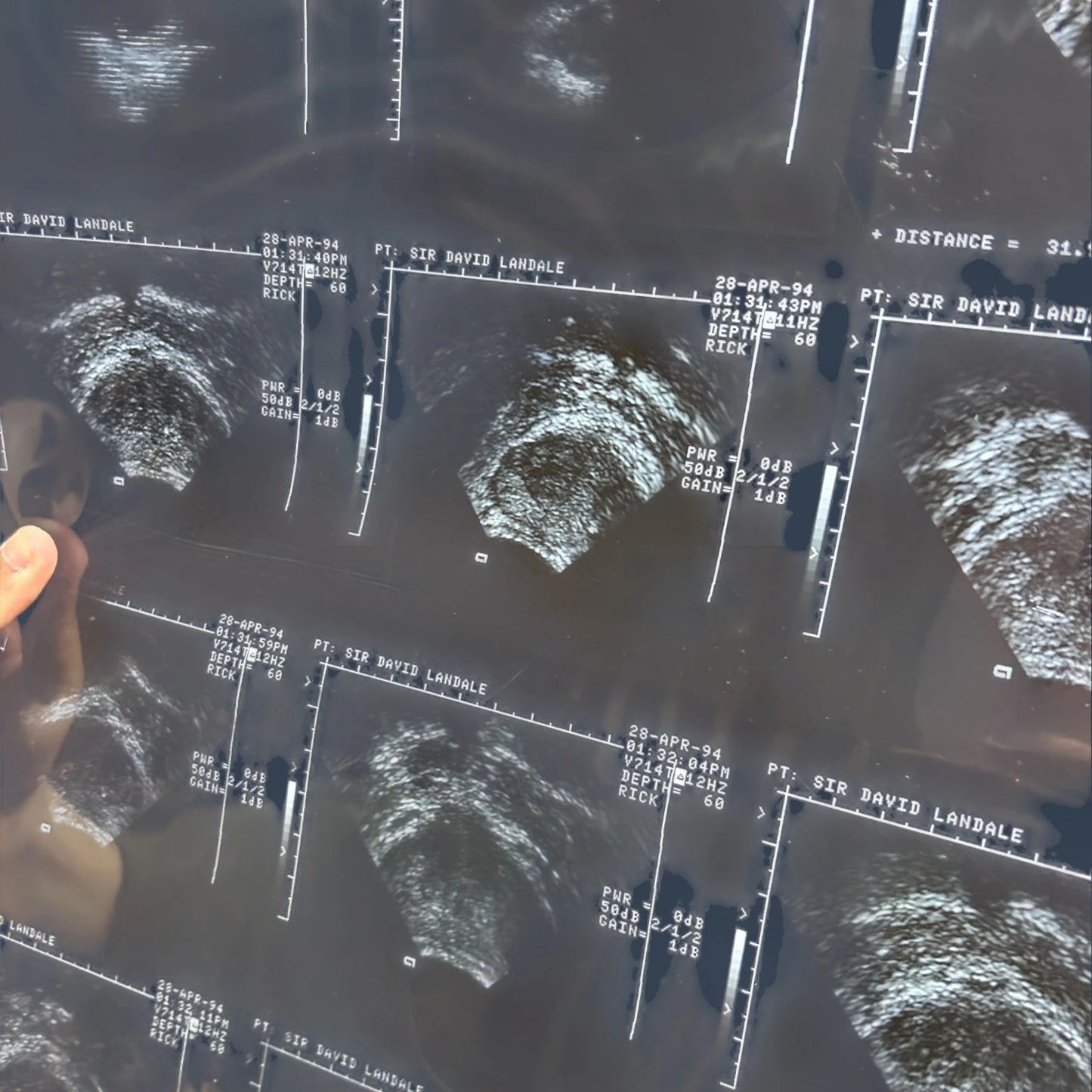 Vintage X Ray Ultrasound Scan Acetate Film Clipping