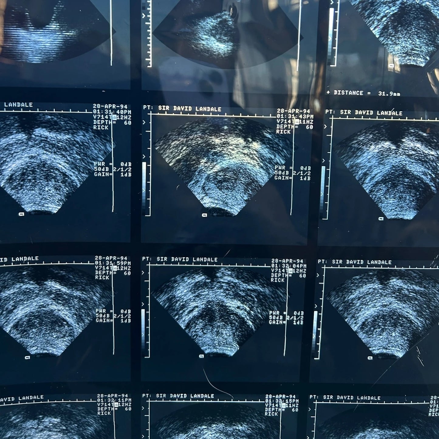 Vintage Medical Ultrasound Film – Retro Sonogram Imaging | Anatomical Wall Art, Science Deco