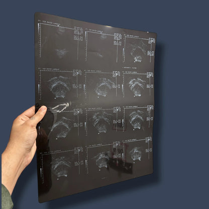 Vintage X Ray Ultrasound Scan Acetate Film Clipping