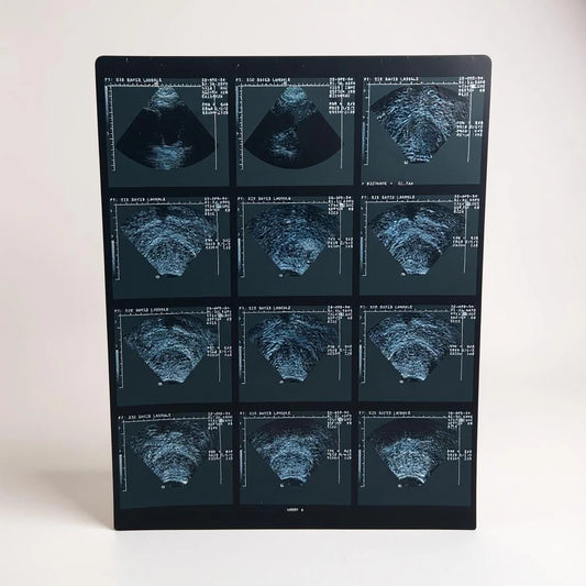 Vintage Medical Ultrasound Film – Retro Sonogram Imaging | Anatomical Wall Art, Science Deco