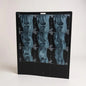 Vintage Knee X-Ray Film – Authentic Medical Imaging Print