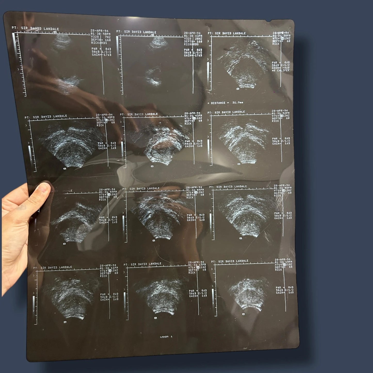 Vintage X Ray Ultrasound Scan Acetate Film Clipping